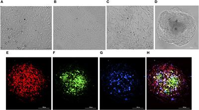 Differential transcriptome response of blood brain barrier spheroids to neuroinvasive Neisseria and Borrelia